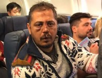 TANDOĞAN - Kiev’de Beşiktaş taraftarına saldırı: Onlarca yaralı var…