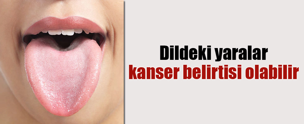 Dildeki yaralar kanser belirtisi olabilir