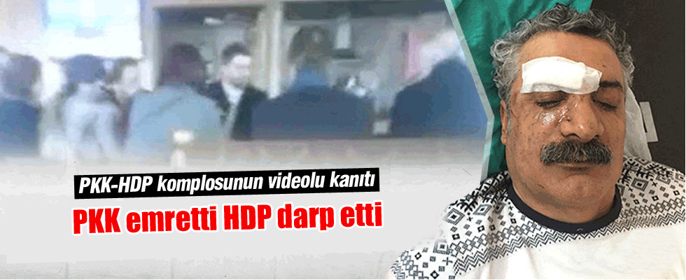 PKK emretti HDP darbetti