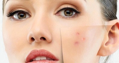 Sivilcelerden Kurtulmanın 6 Yolu