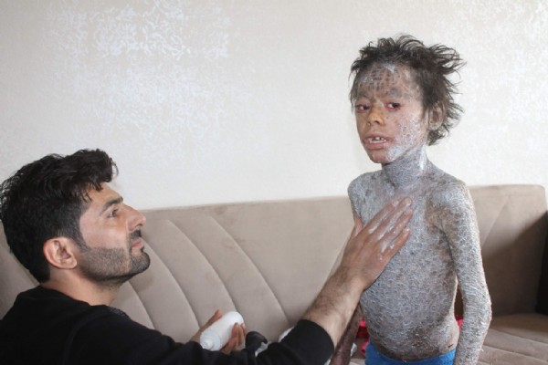 Balık hastalığı hayatını mahvetti