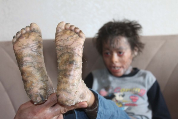 Balık hastalığı hayatını mahvetti