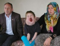 HACETTEPE - Başbakanlığın sahip çıktığı çocuk ameliyat oldu