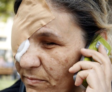 Göz Tansiyonu Hayatını Kararttı