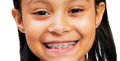 Ağızdan Nefes Alma Çocuklarda Diş Yapısını Bozuyor