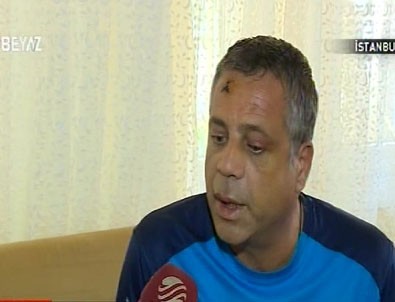 İlgezdi'nin korumalarından dayak yiyen eski belediye çalışanı konuştu