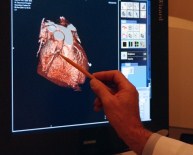 SAĞLIKSIZ BESLENME - Kalp Damarlarında Oluşan Darlık Kalp Hastalığının En Sık Sebeplerinden