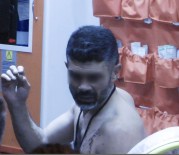 Öfkeli Koca Kırık Camla Kendine Zarar Verdi