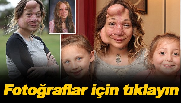 Onun tek bir hayali var!