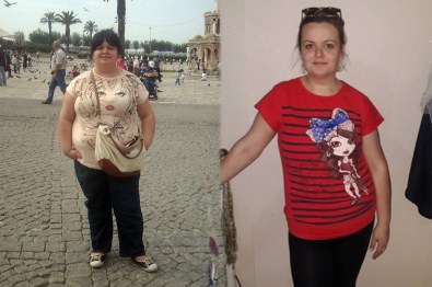 Doktorunun Uyarısıyla 7 Ayda 44 Kilo Verdi
