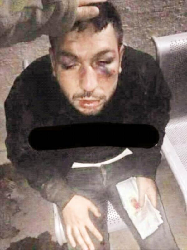 7 polisin katilinden kan donduran itiraf