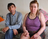 BAHTıLLı - Trafik Kazasında Yanan Kadın Eşinin Desteği İle Hayata Tutundu
