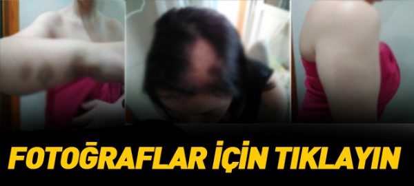 Bu İntihar Değil Cinayet !