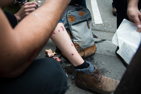 Fransız polisinden sert müdahale