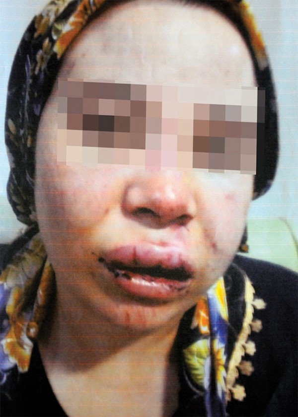 Dayakçı eşini öldüren Damla anlattı: Piknik tüpüyle..