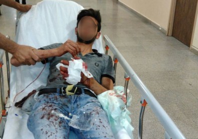 Hazırladığı Patlayıcı Elinde Patladı