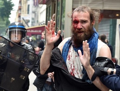 Polisin attığı gaz kapsülü eylemcinin yüzünde patladı