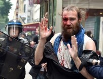 GREV - Polisin attığı gaz kapsülü eylemcinin yüzünde patladı