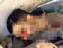 GECEKONDU - Saldırgandan değişik savunma