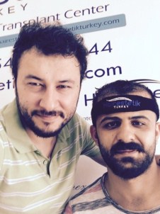 Saç Tıraşsız Saç Ekimi