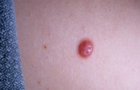 LENF - Benlerdeki Bu Değişimlere Dikkat