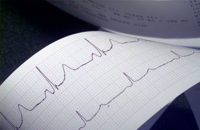 Kalp Hastalarına Oruç Tavsiyeleri