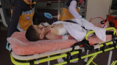 Otomobilin Çarptığı 5 Yaşındaki Çocuk Ağır Yaralandı