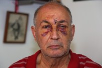 KAN GÖLÜ - Apartman Yöneticisine Tüpçü Dayağı