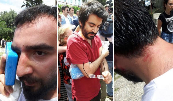 Ihlamur Parkı protestosunda arbede