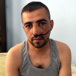 Boğaziçi Köprüsü'nde Yaralanan Hamit Hakan Yılmaztürk, O Anları Anlattı Açıklaması