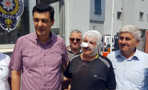 Cumhurbaşkan'ına hakaret edeni uyarınca dayak yedi