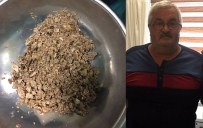 Bu Taşlar Böbreğinden Çıktı