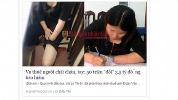 Sigortadan para almak için kolunu ve bacağını kesti!