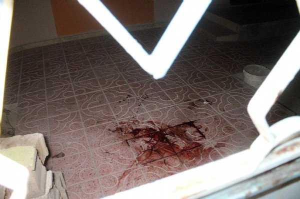 Ağabeyini 7 yerinden bıçakladı