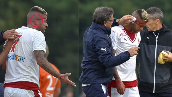 Yıldız futbolcunun kulağı koptu!