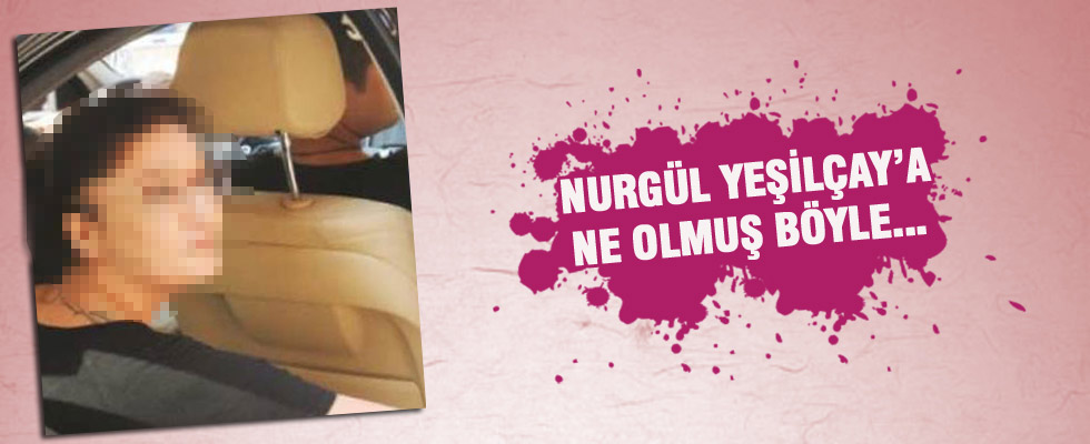 Nurgül Yeşilçay'ın saçları dökülüyor