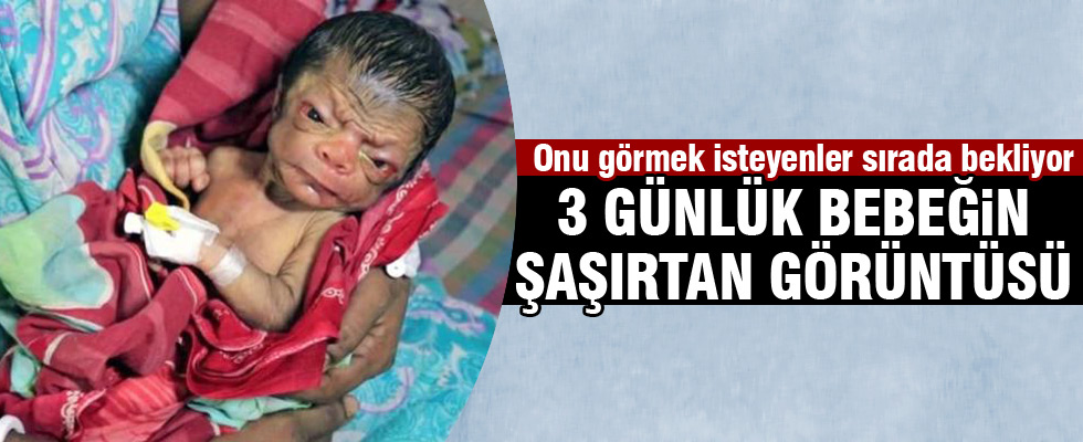 3 günlük bebeği görenler şaşırıyor