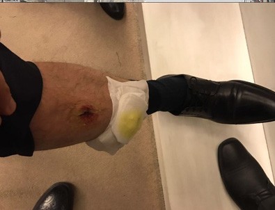 Bacağı ısırıldı, DNA testi istedi