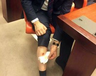 CHP'li Vekil AK Partili Vekili Bacağından Isırdı