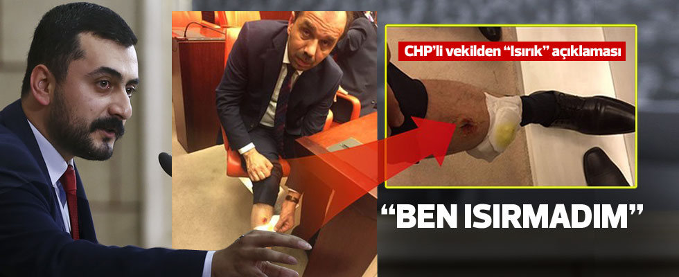 Eren Erdem'den 'ısırma' açıklaması