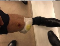 Eren Erdem AK Partili vekili bacağından ısırdı