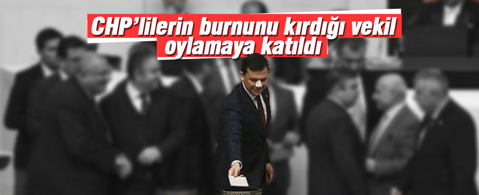 Burnu kırılan Fatih Şahin oylamaya katıldı