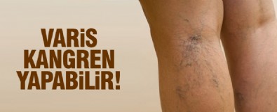 Varis kangrene neden olabilir