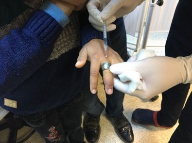 Çocuğun Parmağına Sıkışan Yüzük Hastanede Çıkartıldı