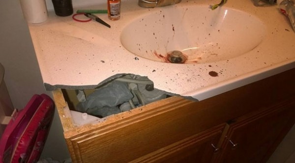 Elektronik sigara yüzünde patladı!