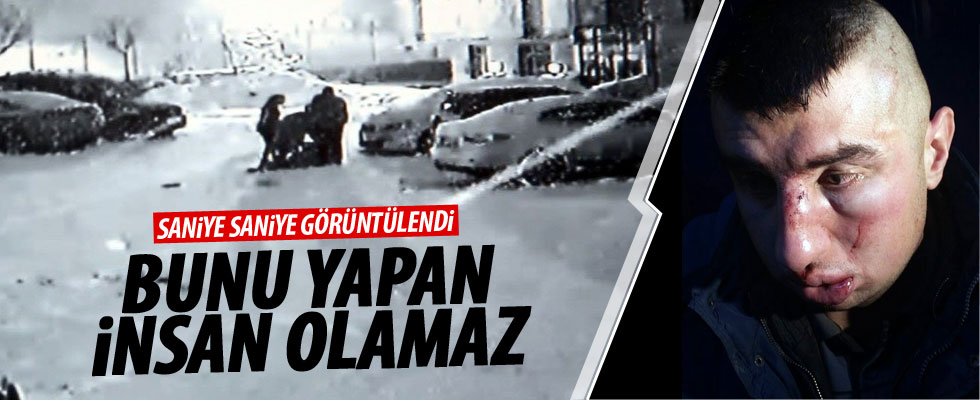 Erzurum'da zihinsel engelli gence aile boyu dayak