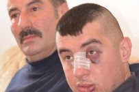 ZİHİNSEL ENGELLİLER - Zihinsel engelli genci ailece dövdüler!