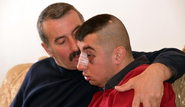 Zihinsel engelli genci ailece dövdüler!