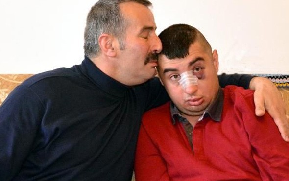 Zihinsel engelli genci ailece dövdüler!