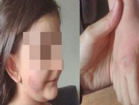 DOKTOR RAPORU - 5 yaşındaki öz kızına işkence yapan babaya 12. 5 yıl hapis